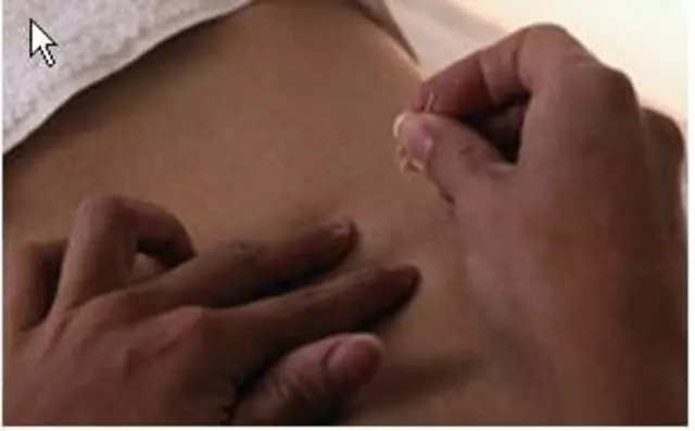 Amy Fu, LAc - Acupuncture USA