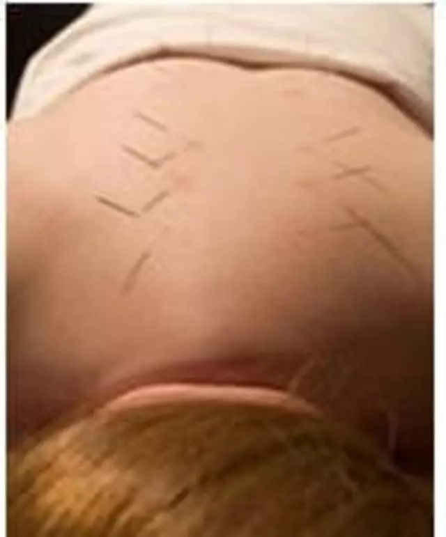 Amy Fu, LAc - Acupuncture USA