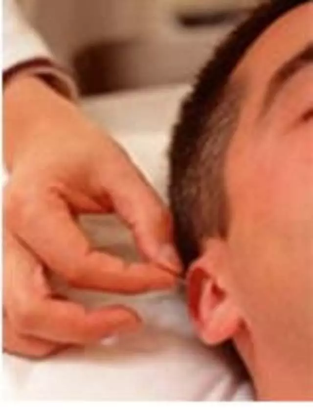 Amy Fu, LAc - Acupuncture USA